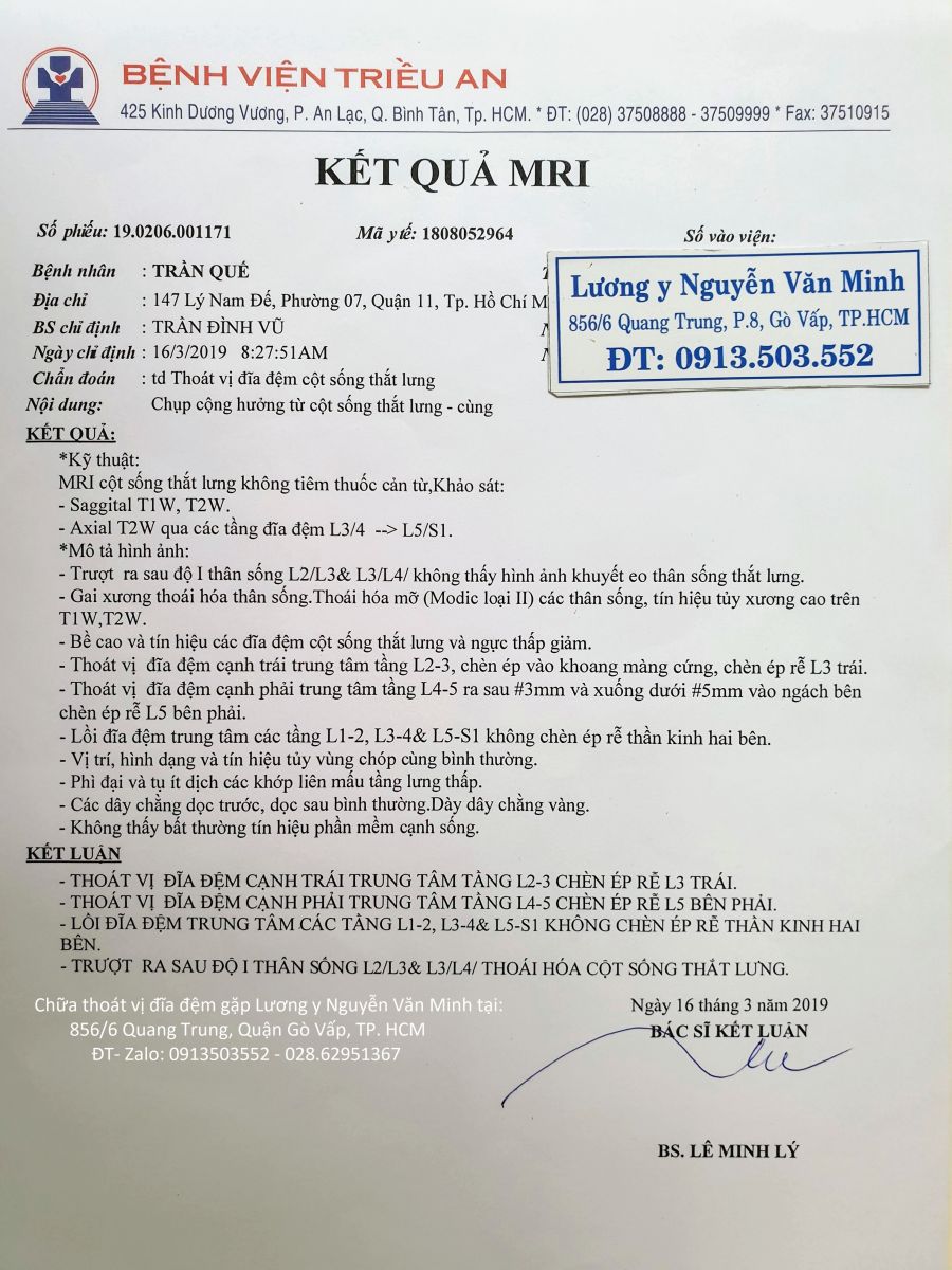 Chữa thoát vị đĩa đệm bằng đông y